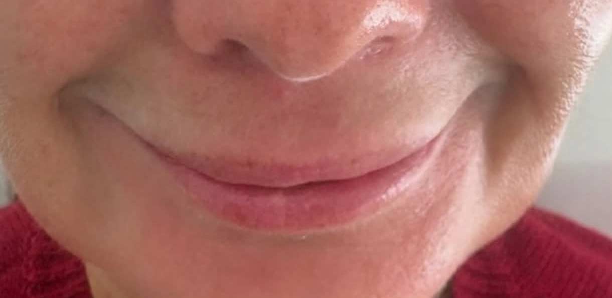 Before